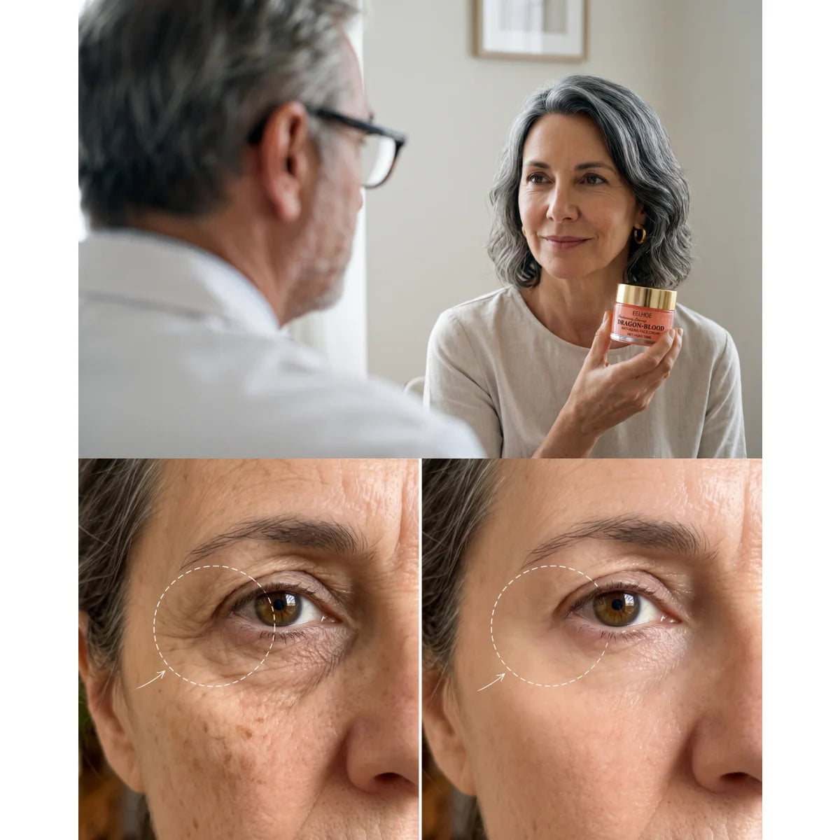 Un cirujano plástico observa el rostro de una mujer de 57 años, y el detalle del antes y el después del contorno de ojos