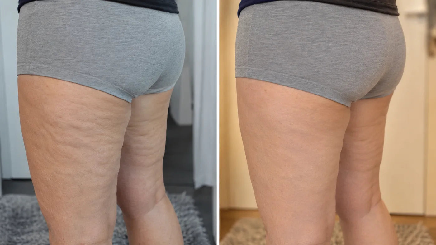 La misma mujer, antes y después de seis semanas con la rutina