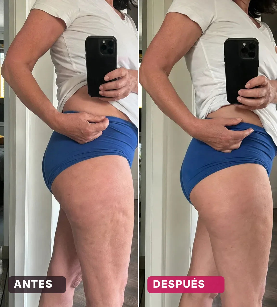 Lorena P. — antes y después de 6 semanas con Candela